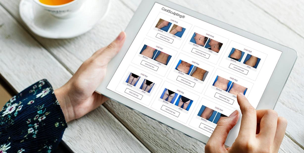 A practice website gallery of before-and-after cases viewed on a tablet, powered by Perfect Photo